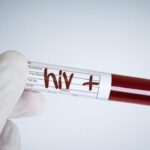 Pesta Gay Puncak Bogor: 30 Tamu Reaktif HIV-Sifilis, Gegerkan Publik