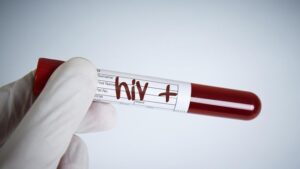 Pesta Gay Puncak Bogor: 30 Tamu Reaktif HIV-Sifilis, Gegerkan Publik