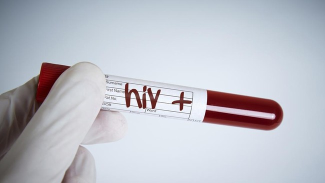 Pesta Gay Puncak Bogor: 30 Tamu Reaktif HIV-Sifilis, Gegerkan Publik